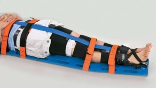 This image depicts the last application step of which splint?   A)  The SEFRS Adaptor B)  The Sager SX 405 Unipolar Traction Splint C)  A SAM Splint D)  A Bipolar Traction Splint