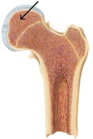 The bony upper left region of this femur is called the   A)  epiphysis. B)  epiphyseal plate. C)  diaphysis. D)  compact bone.