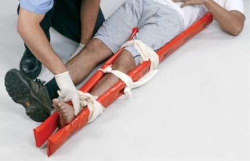 What does this image depict?   A)  Immobilization of the lower leg by an air splint. B)  Immobilization of the lower leg by a SAM splint. C)  Immobilization of the lower leg by padded boards. D)  Immobilization of the lower leg by a traction splint.