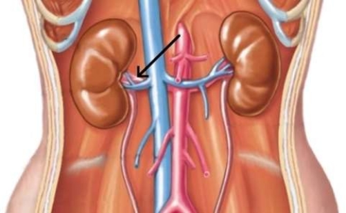 <strong>In the picture below, the arrow is pointing to the  </strong> A) inferior vena cava. B) aorta. C) renal artery. D) renal vein. <div style=padding-top: 35px> 