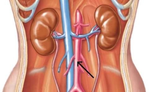 <strong>In this picture, the arrow is pointing to the  </strong> A) inferior vena cava. B) renal artery. C) renal vein. D) descending aorta. <div style=padding-top: 35px> 