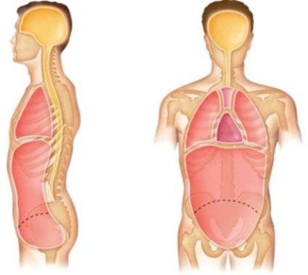 <strong>The dorsal cavity contains the </strong> A) cranial cavity and vertebral canal. B) pericardial cavity and diaphragm. C) abdominal cavity and pelvic cavity. D) thoracic cavity and abdominopelvic cavity.