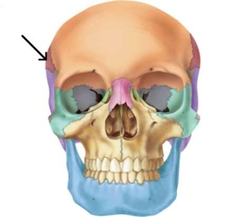 <strong>The arrow is pointing to the </strong> A) frontal bone. B) temporal bone. C) parietal bone. D) occipital bone.