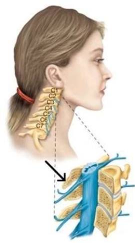 The arrow is pointing to the part of the vertebra on the posterior side of the body,   which is called the A)  body. B)  spinal cord. C)  disk. D)  spinous process.
