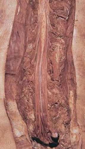 <strong>This picture shows the dissection of a(n) </strong> A) aorta. B) spinal cord. C) femur bone. D) muscle.