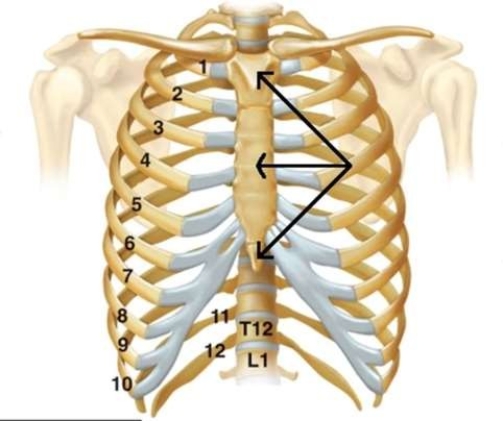 <strong>The arrows in the image are pointing to the bones that make up which part of the human ribcage? </strong> A) True Ribs B) Clavicle C) Sternum D) False Ribs