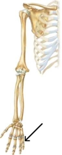 <strong>The arrow points to which part of the hand? </strong> A) Radius B) Carpals C) Phalanges D) Metacarpals