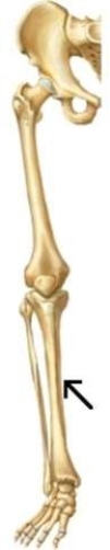 <strong>In the diagram, the arrow is pointing to which part of the leg? </strong> A) Femur B) Tibia C) Fibula D) Patella