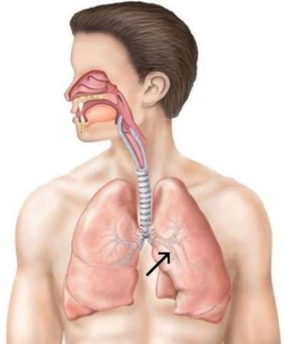 <strong>This section of the bronchial tree is known as a </strong> A) secondary bronchus. B) minor bronchus. C) middle bronchus. D) distal bronchus.