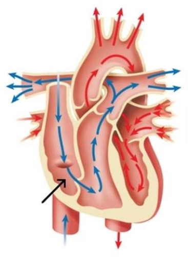 <strong>In this image, the black arrow is pointing to the </strong> A) left atrium. B) right ventricle. C) right atrium. D) left ventricle.