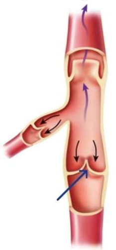 <strong>What is the function of the structure indicated in the image by the blue arrow? </strong> A) To prevent the back flow of blood B) To push blood towards the heart C) To push blood towards the body D) To separate arteries from veins