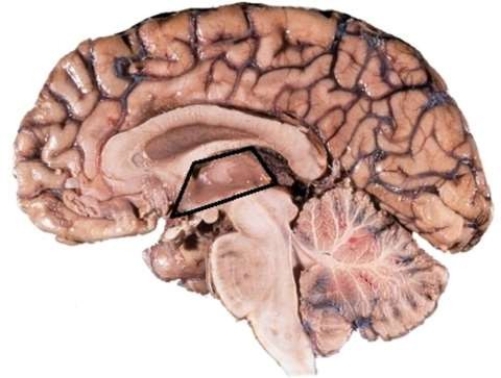 <strong>The parts of the diencephalon are </strong> A) the midbrain, pons, and medulla oblongata. B) the thalamus and hypothalamus. C) the cerebrum and corpus callosum. D) the cerebellum, midbrain, and hypothalamus.