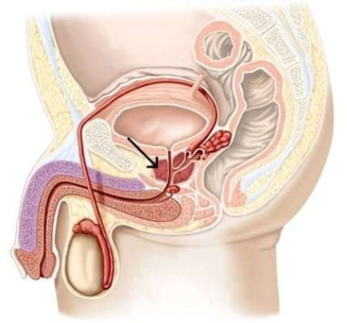 <strong>What is the function of this structure? </strong> A) Secreting an alkaline fluid that activates sperm. B) Storing sperm as they finish maturing. C) Secreting a fructose-rich fluid that carries sperm. D) Transporting semen to the urethra.