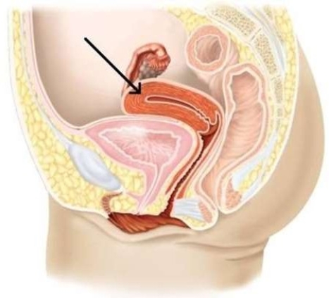 <strong>In this picture, which reproductive structure is indicated? </strong> A) Bladder B) Vagina C) Cervix D) Uterus