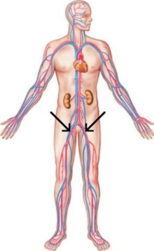 <strong>These arteries are called the </strong> A) inferior mesenteric arteries. B) common iliac arteries. C) superior mesenteric arteries. D) peripheral iliac arteries.