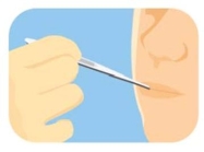 <strong>Complete la oración según la imagen.El enfermero le _____ a Leonardo en la clínica.  </strong> A) le pone una inyección B) le toma la temperatura C) le da pastillas D) receta una medicina <div style=padding-top: 35px> 