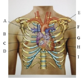 Where would the nurse place a stethoscope to assess the Point of Maximal Impulse (PMI) ?   A)  B B)  D C)  E D)  I