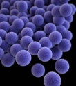 This is an example of what general group of bacteria?   