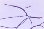 This is an example of what general group of bacteria?   
