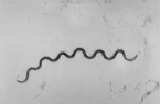 This is an example of what general group of bacteria?   