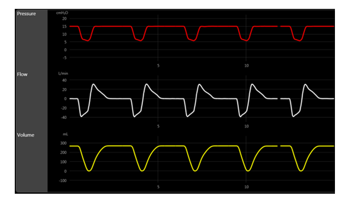 Based on the scenario displayed on the scalars below, which of the following maneuvers is indicated at this point?   A)  Remove the expiratory filter to determine gas trapping B)  Inspiratory hold to measure plateau pressure C)  Expiratory hold to measure auto-PEEP D)  Increase the rise time