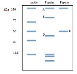 On the gel below, which bands would you expect to bind antigen? ​    A) B and A B) B and B C) B and C D) B and D E) B and A, B, and C