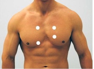 Which figure below correctly shows the four sites used for auscultation of heart sounds? A)    B)    C)    D)    E)   