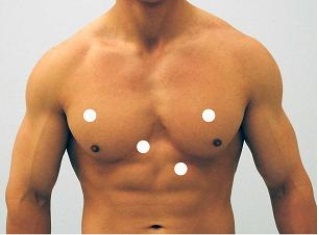 Which figure below correctly shows the four sites used for auscultation of heart sounds? A)    B)    C)    D)    E)   