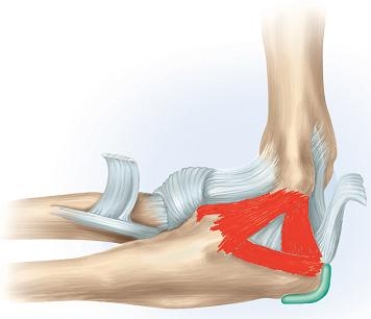 In which of the following movements is the highlighted structure in the given figure of major importance?   A)  Forceful extension-pronation movement B)  Forceful extension-supination movement C)  Forceful extension movement D)  Forceful flexion-supination movement E)  Forceful flexion-pronation movement