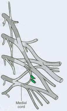 What is the CORRECT title of the highlighted peripheral nerve?   A)  Pectoral nerve (medial and lateral)  B)  Dorsal scapular nerve (posterior)  C)  Axillary nerve D)  Musculocutaneous nerve E)  Suprascapular nerve