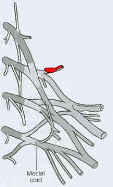 What is the CORRECT title of the highlighted peripheral nerve?   A)  Pectoral nerve B)  Dorsal scapular nerve C)  Axillary nerve D)  Musculocutaneous nerve E)  Suprascapular nerve