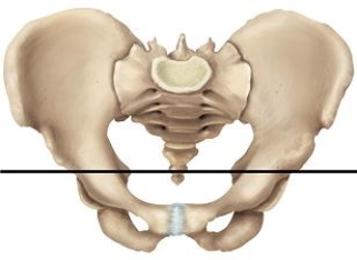 Please draw a line in the correct location that separates the false and true pelvic areas. A)    B)    C)    D)    E)   