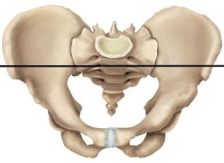 Please draw a line in the correct location that separates the false and true pelvic areas. A)    B)    C)    D)    E)   
