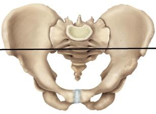 Please draw a line in the correct location that separates the false and true pelvic areas. A)    B)    C)    D)    E)   