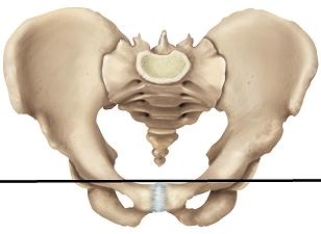 Please draw a line in the correct location that separates the false and true pelvic areas. A)    B)    C)    D)    E)   
