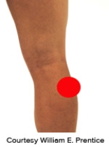 <strong>Please identify the correct location of a baker's cyst.</strong> A)   B)   C)   D)   E)   <div style=padding-top: 35px> 