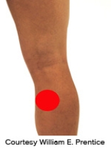 <strong>Please identify the correct location of a baker's cyst.</strong> A)   B)   C)   D)   E)   <div style=padding-top: 35px> 