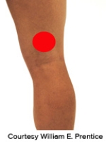<strong>Please identify the correct location of a baker's cyst.</strong> A)   B)   C)   D)   E)   <div style=padding-top: 35px> 