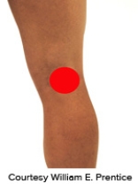 <strong>Please identify the correct location of a baker's cyst.</strong> A)   B)   C)   D)   E)   <div style=padding-top: 35px> 
