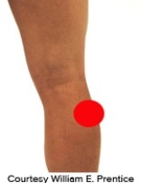 <strong>Please identify the correct location of a baker's cyst.</strong> A)   B)   C)   D)   E)   <div style=padding-top: 35px> 