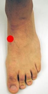 <strong>Please identify the area of the foot where a Jones fracture would most likely occur.</strong> A)   B)   C)   D)   E)   <div style=padding-top: 35px> 