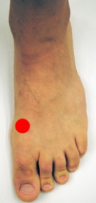 <strong>Please identify the area of the foot where a Jones fracture would most likely occur.</strong> A)   B)   C)   D)   E)   <div style=padding-top: 35px> 