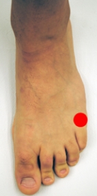 <strong>Please identify the area of the foot where a Jones fracture would most likely occur.</strong> A)   B)   C)   D)   E)   <div style=padding-top: 35px> 
