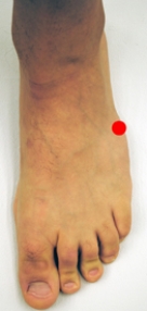 <strong>Please identify the area of the foot where a Jones fracture would most likely occur.</strong> A)   B)   C)   D)   E)   <div style=padding-top: 35px> 