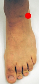 <strong>Please identify the area of the foot where a Jones fracture would most likely occur.</strong> A)   B)   C)   D)   E)   <div style=padding-top: 35px> 