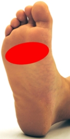 <strong>Please identify the area where callus develops on a person who is suffering from metatarsalgia.</strong> A)   B)   C)   D)   E)   <div style=padding-top: 35px> 