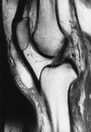 Which of the following imaging techniques illustrated in the pictures would be the most efficient to discover if there is a nerve root compression at the L<sub>4</sub> level? A) B) C) D) E)