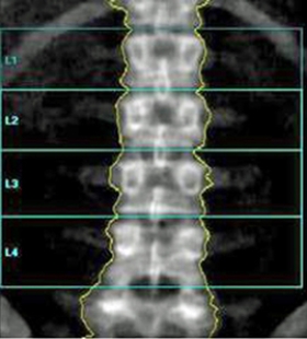 Which of the following imaging techniques illustrated in the pictures would be the most efficient to discover if there is a nerve root compression at the L<sub>4</sub> level? A) B) C) D) E)