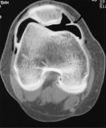 Which of the following imaging techniques illustrated in the pictures would be the most efficient to discover if there is a nerve root compression at the L<sub>4</sub> level? A) B) C) D) E)