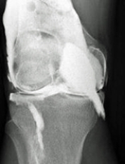 Which of the following imaging techniques illustrated in the pictures would be the most efficient to discover if there is a loose body within a joint? A) B) C) D) E)